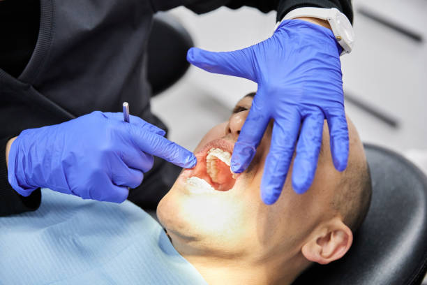 Best Dentist for Tooth Abscess  in New Kingman Butler, AZ